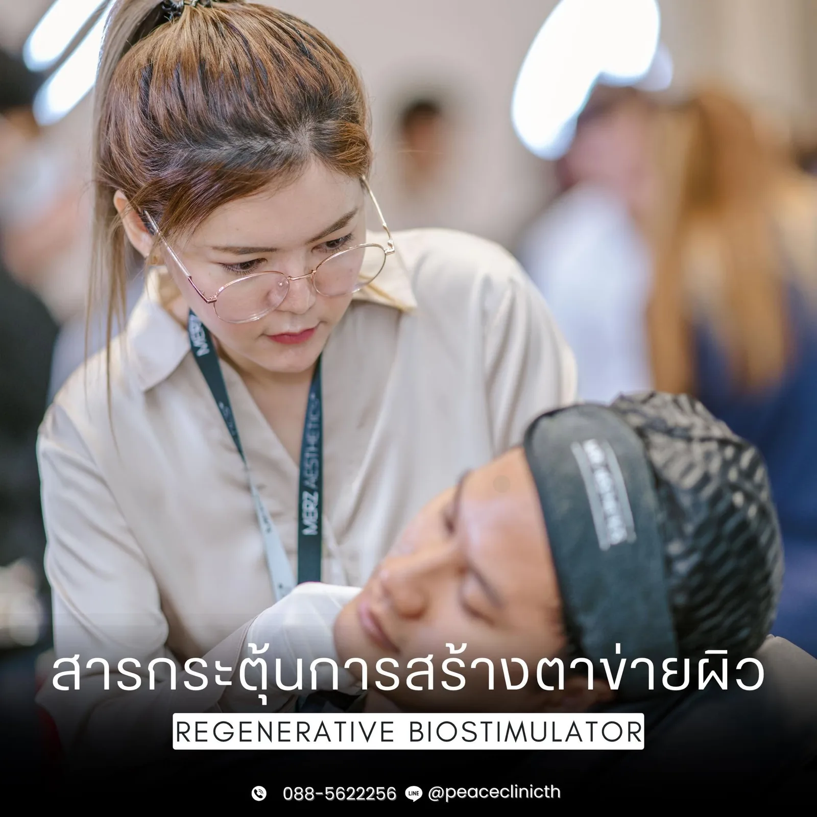 เทรนนิ่งเทคนิคการฉีด Radiesse