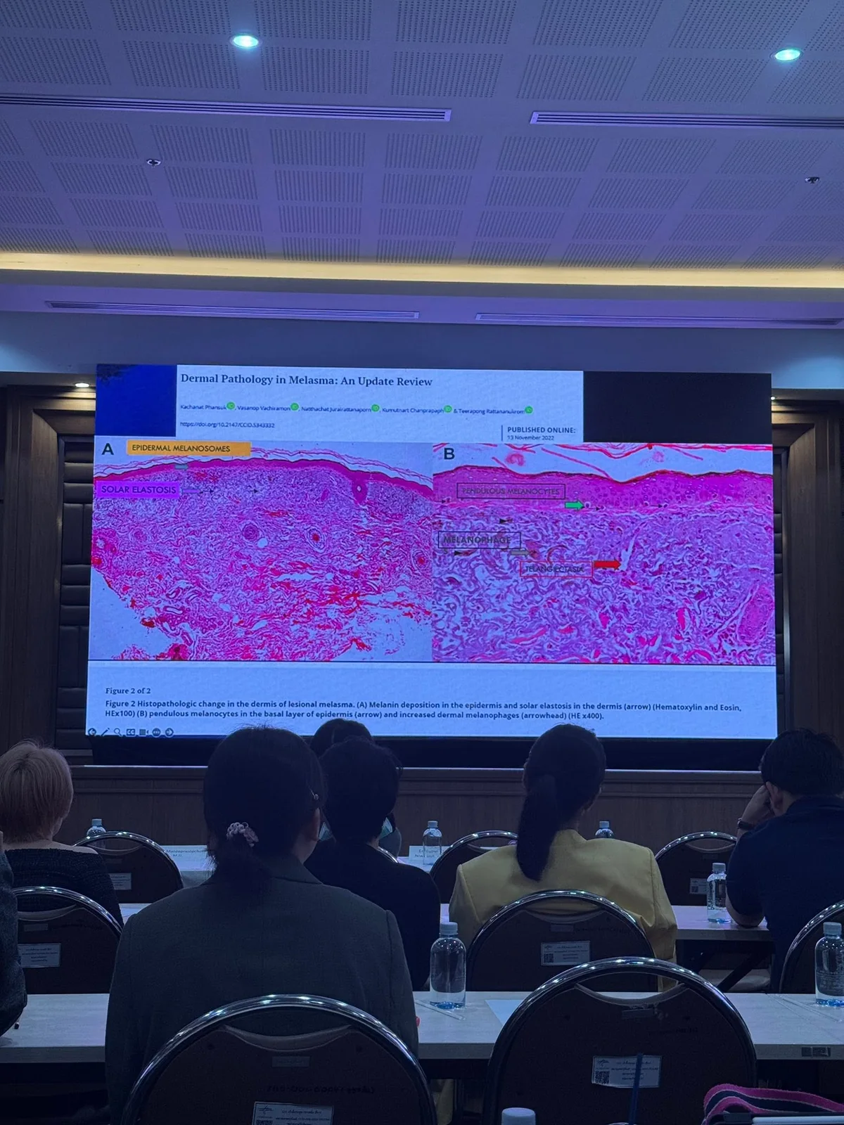 เรียนซ้ำกับอาจารย์นิวัติ — เลเซอร์ เม็ดสี และ Learning Curve ที่ไม่มีวันหยุด