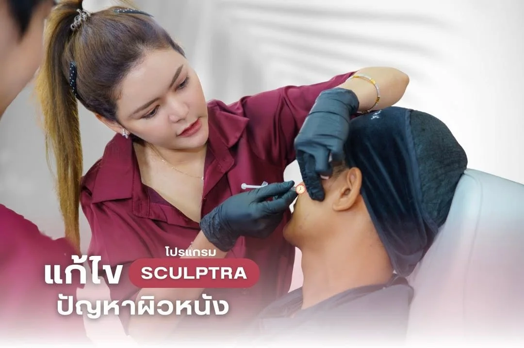 โปรแกรม Sculptra แก้ไขปัญหาผิวหนัง