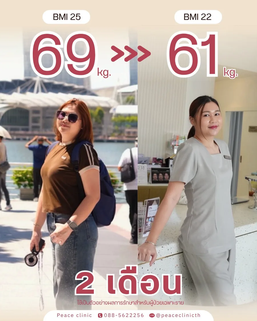 ปักปากกาลดน้ำหนัก · 69 → 61 กก. — BMI 25 → 22 · 2 เดือน