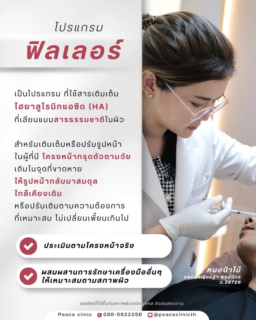 โปรแกรมฟิลเลอร์ ใช้สารเติมเต็มไฮยาลูโรนิกแอซิด (HA) เติมในจุดที่ขาดหาย ให้รูปหน้ากลับมาสมดุลใกล้เคียงเดิม