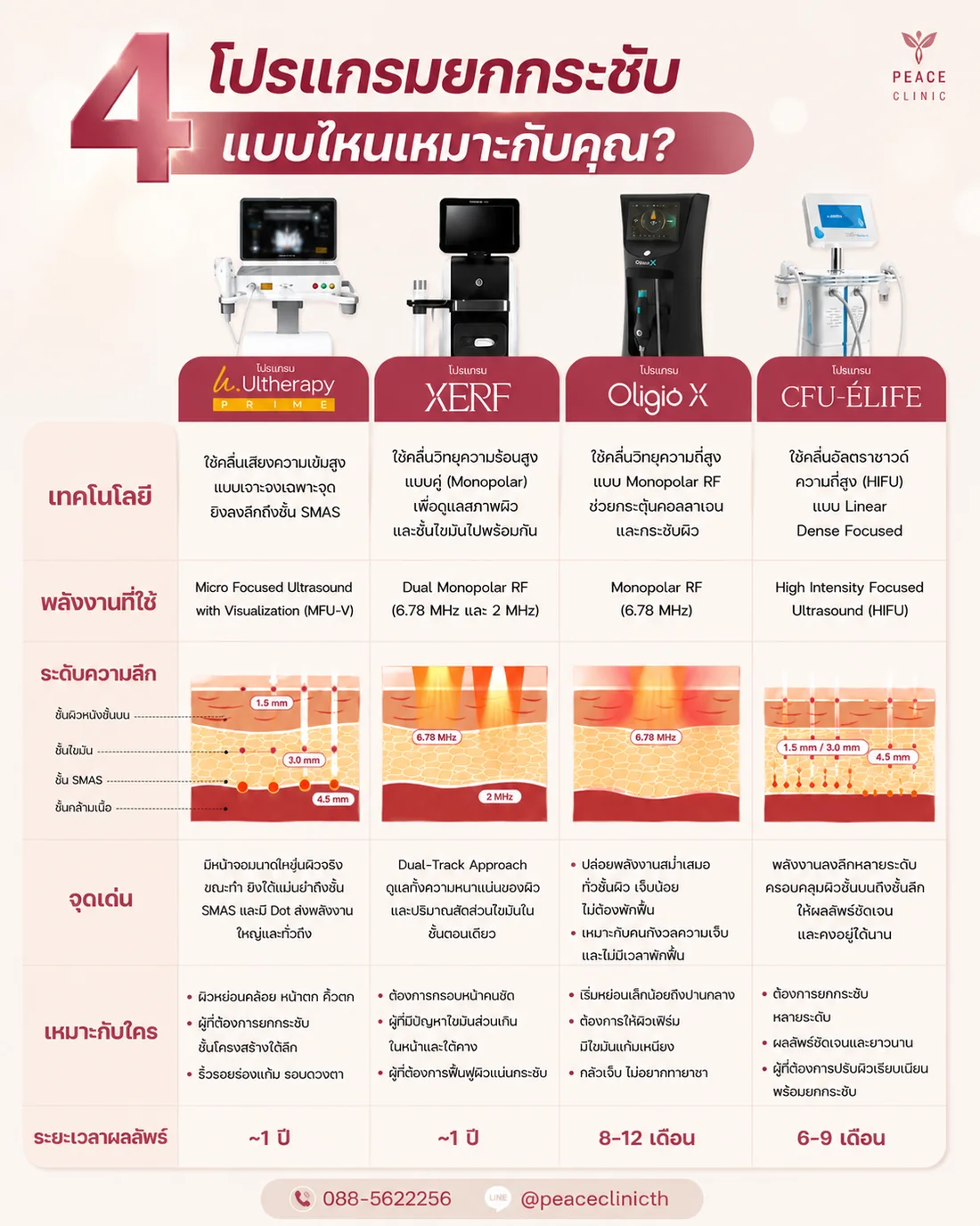 เทียบ 4 โปรแกรมยกกระชับที่ Peace Clinic แม่สอด Ultherapy PRIME ไมโครโฟกัสอัลตราซาวด์ลงชั้น SMAS · XERF คลื่นวิทยุสองความถี่ · Oligio X คลื่นวิทยุโมโนโพลาร์ · CFU-ELIFE อัลตราซาวด์โฟกัส เทียบเทคโนโลยี ความลึก จุดเด่น และระยะเวลาผลลัพธ์
