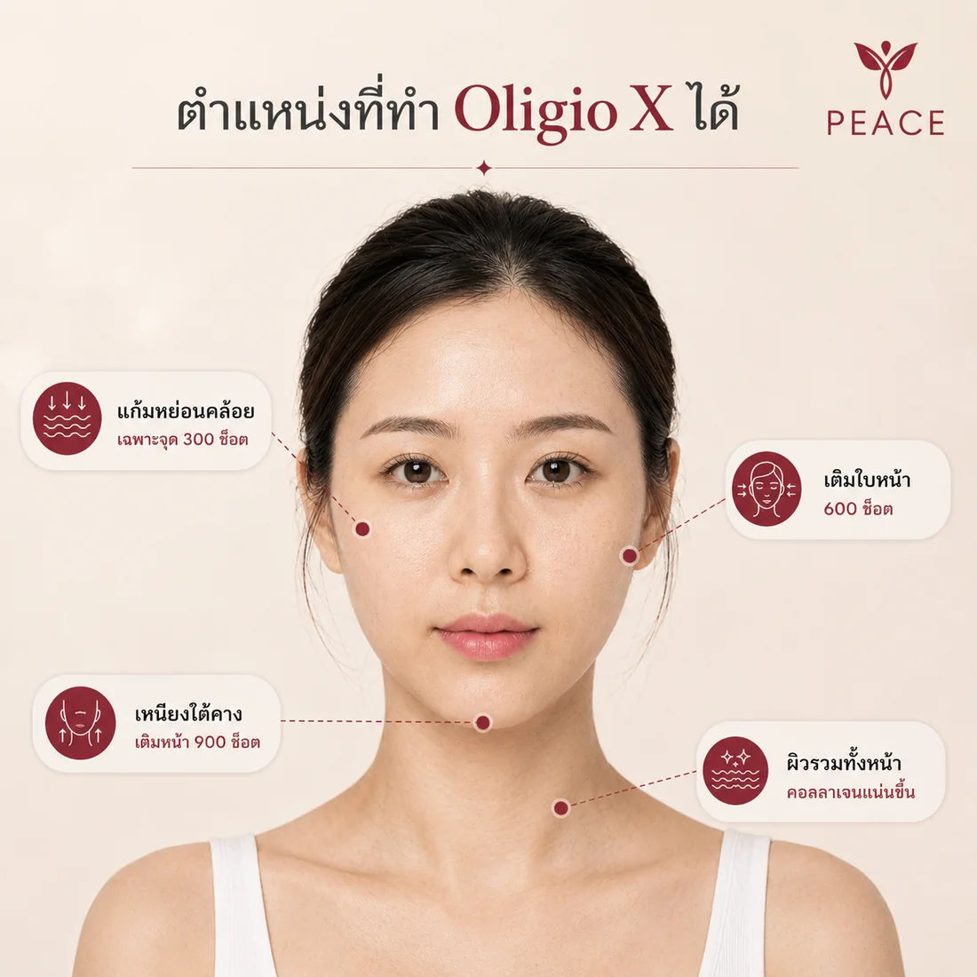 แผนผังใบหน้าแสดงตำแหน่งที่ทำ Oligio X ได้ แก้มหย่อนคล้อยเฉพาะจุด 300 ช็อต เต็มใบหน้า 600 ช็อต เหนียงใต้คางเต็มหน้า 900 ช็อต และผิวรวมทั้งหน้าที่คอลลาเจนแน่นขึ้น
