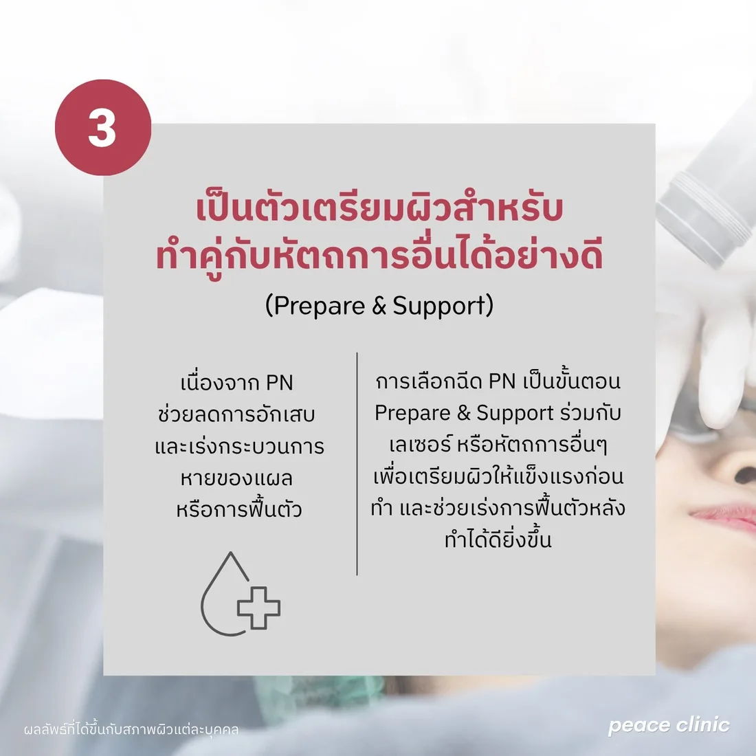 PN ช่วยลดการอักเสบและเร่งกระบวนการหายของแผล จึงใช้เป็นขั้นตอน Prepare & Support ร่วมกับเลเซอร์หรือหัตถการอื่น เตรียมผิวให้แข็งแรงก่อนทำและเร่งการฟื้นตัวหลังทำ