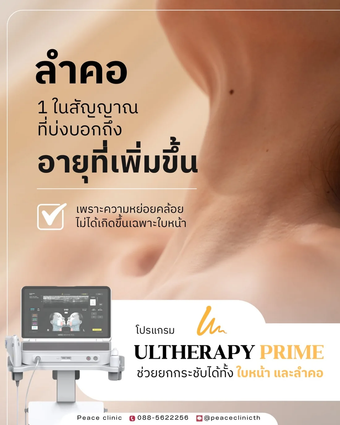โปรแกรม Ultherapy Prime เครื่องยกกระชับด้วยอัลตราซาวด์จาก Merz ช่วยยกกระชับได้ทั้งใบหน้าและลำคอ ที่ Peace Clinic แม่สอด