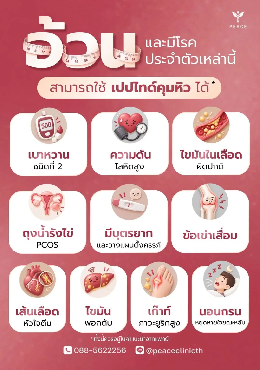 ผู้ที่น้ำหนักเกินและมีโรคประจำตัวเหล่านี้อาจใช้เปปไทด์คุมหิวได้ ภายใต้คำแนะนำของแพทย์ — เบาหวานชนิดที่ 2 · ความดันโลหิตสูง · ไขมันในเลือดผิดปกติ · ถุงน้ำรังไข่ PCOS · มีบุตรยากและวางแผนตั้งครรภ์ · ข้อเข่าเสื่อม · เส้นเลือดหัวใจตีบ · ไขมันพอกตับ · เก๊าท์และภาวะยูริกสูง · นอนกรนและหยุดหายใจขณะหลับ
