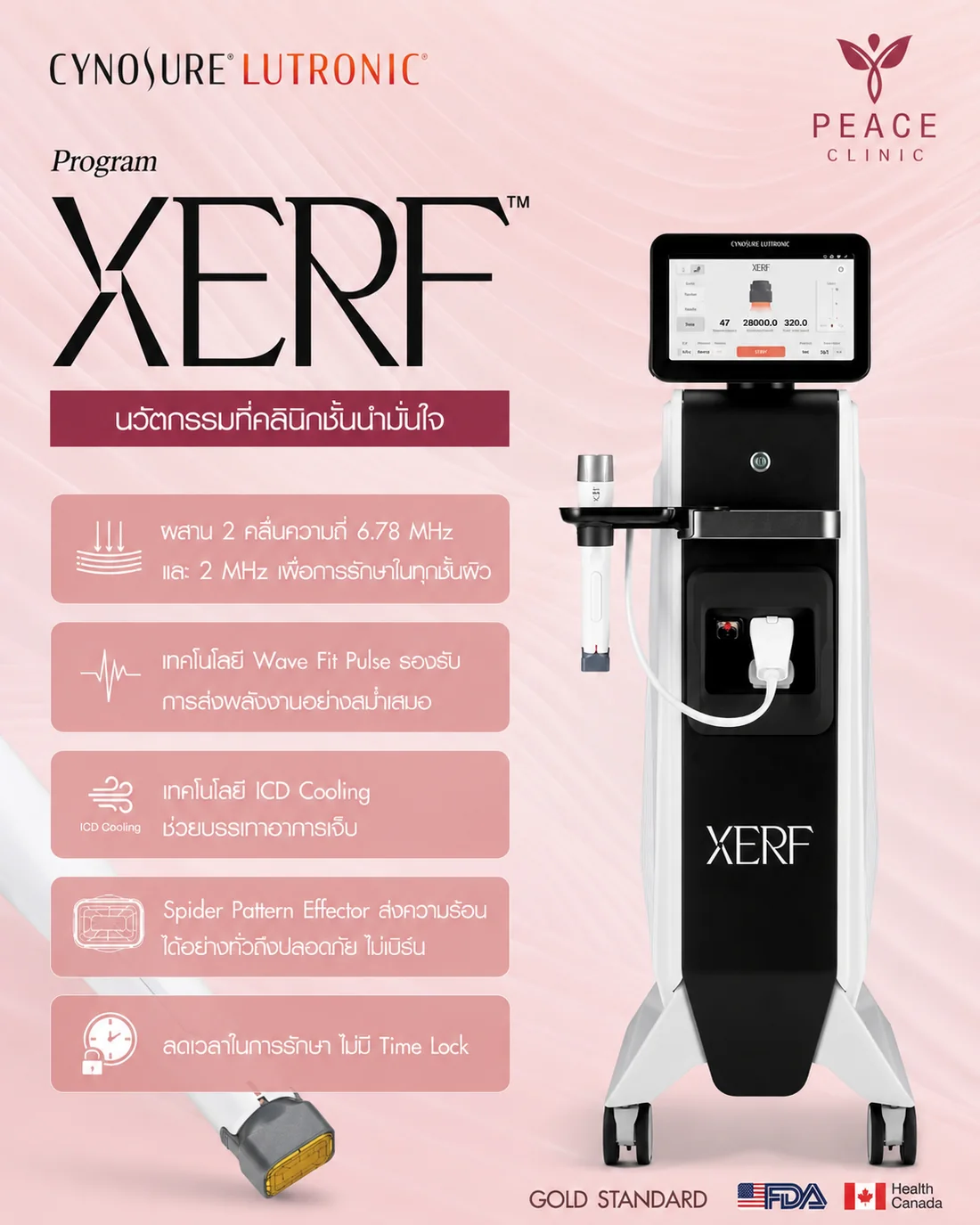 สเปกเครื่อง XERF จาก Cynosure Lutronic — คลื่นสองความถี่ 6.78 และ 2 MHz ครอบคลุมทุกชั้นผิว · Wave Fit Pulse ส่งพลังงานสม่ำเสมอ · ICD Cooling ลดความเจ็บ · Spider Pattern Effector กระจายความร้อนทั่วถึงไม่เบิร์น · ไม่มี Time Lock ผ่านการรับรอง US FDA และ Health Canada