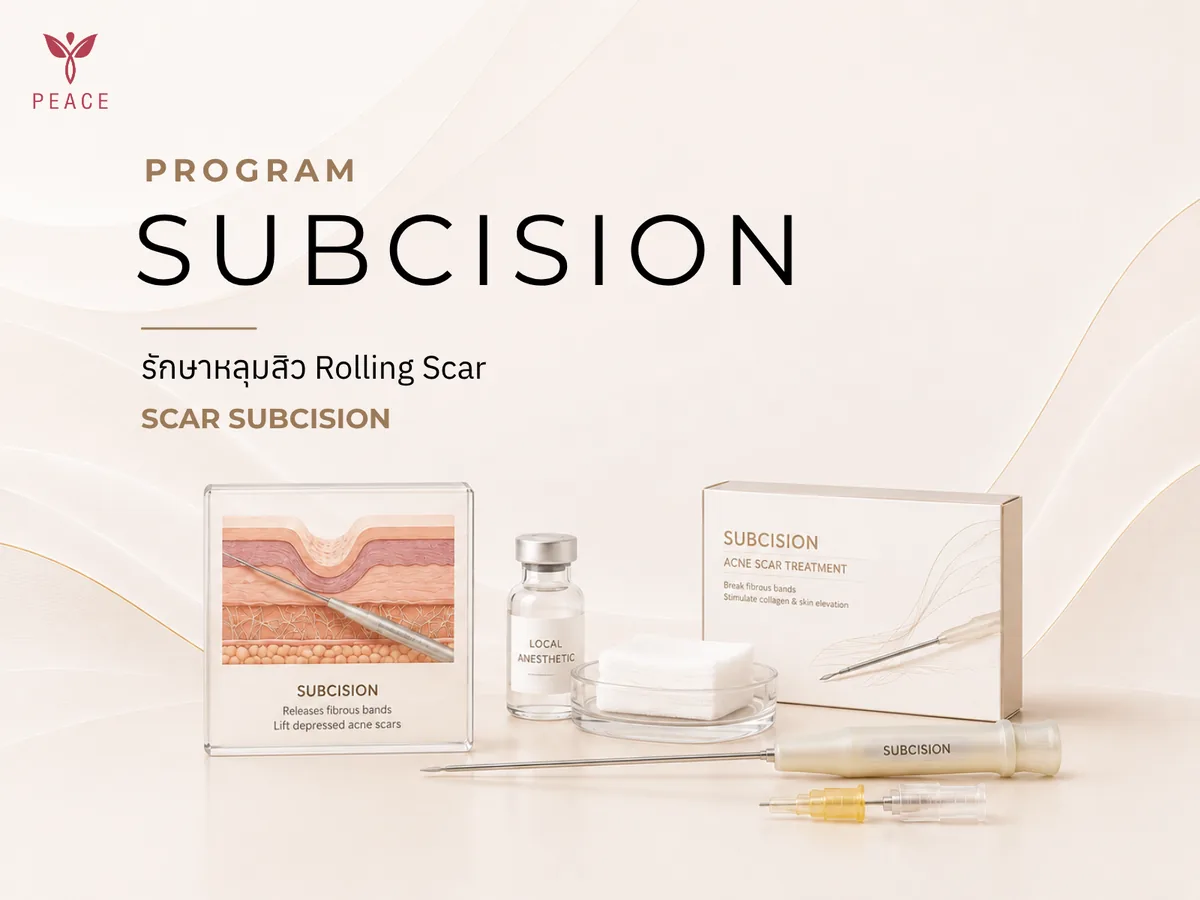 Subcision ที่ Peace Clinic แม่สอด