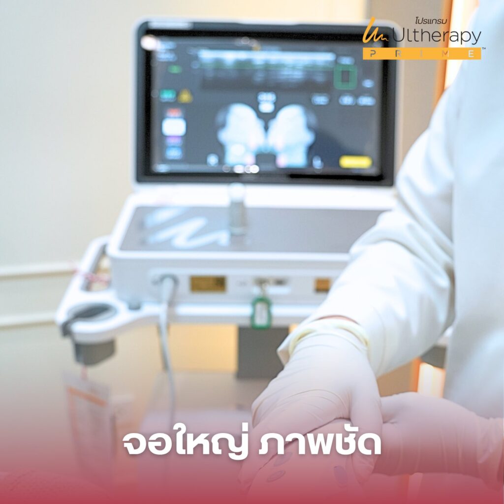 Ultherapy Prime แม่สอด