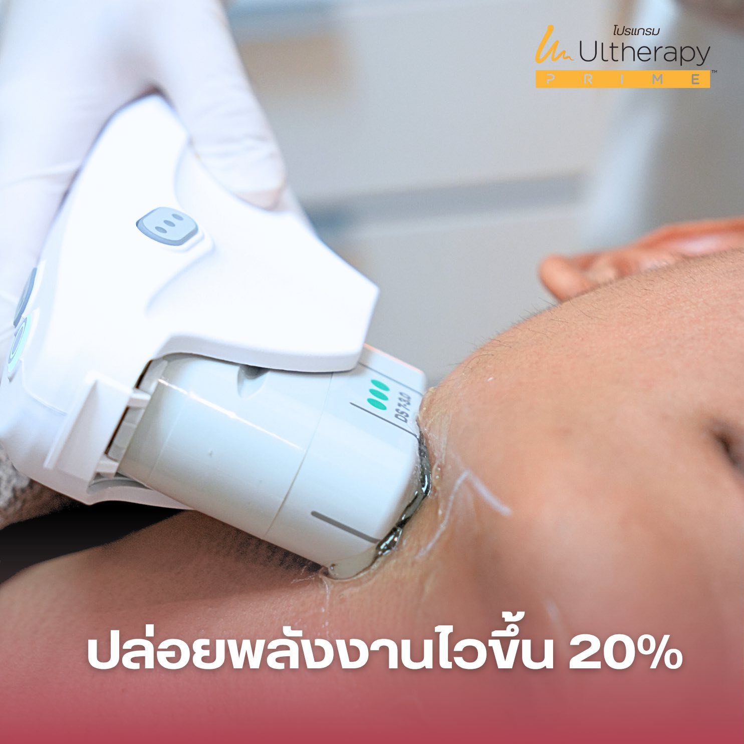 Ultherapy Prime แม่สอด
