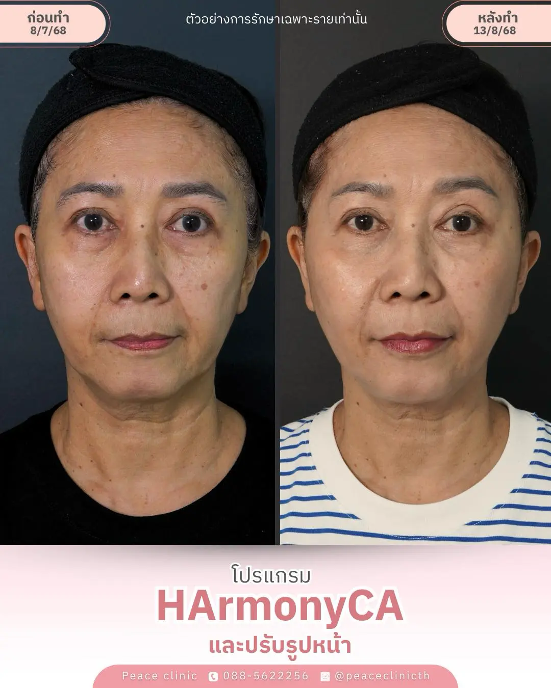 534973723_1369695978489471_6088233170790324339_n