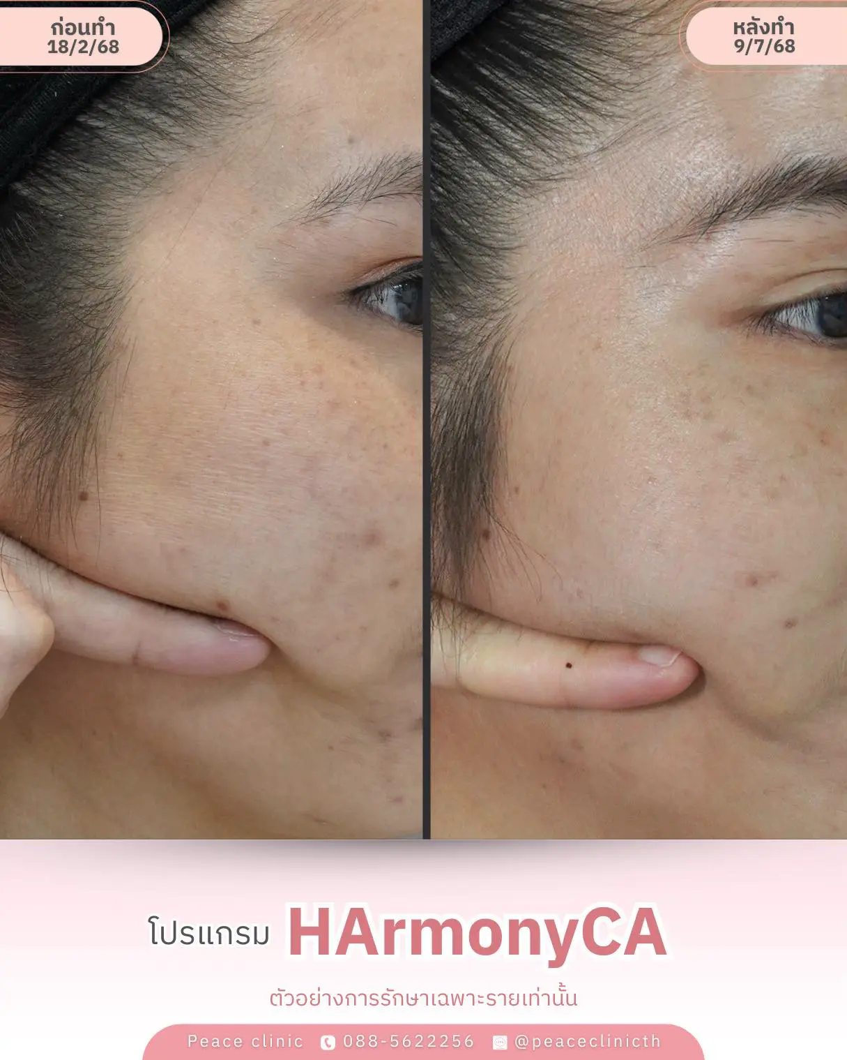 536670955_1374392938019775_449356869634236298_n