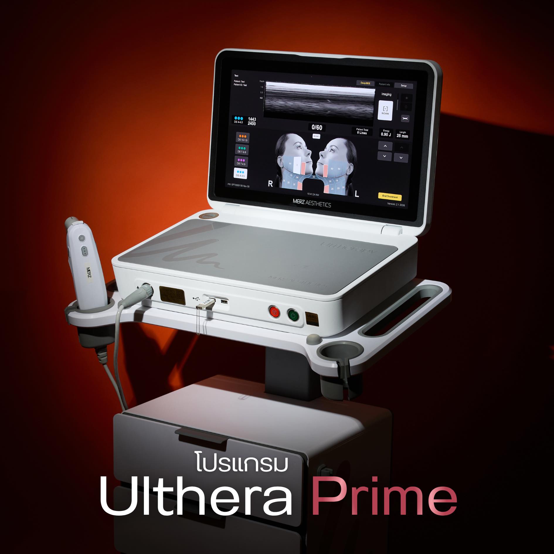 Ultherapy Prime แม่สอด